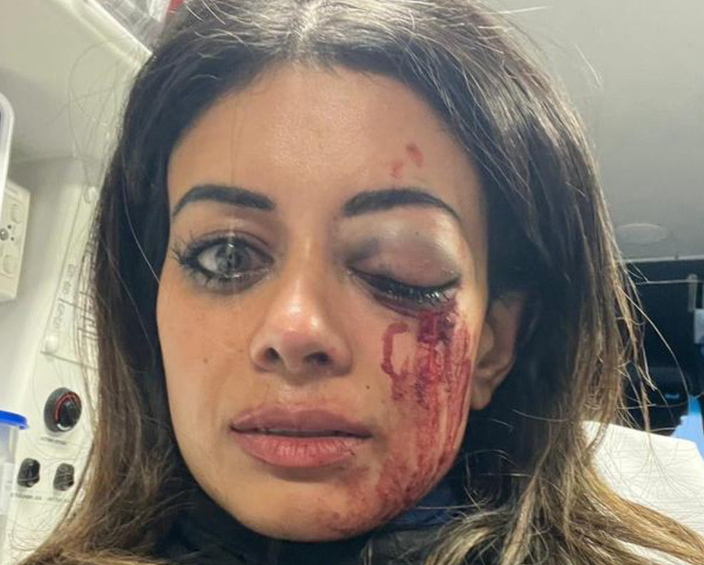 NSW Police injure protestor and claim all in a days work